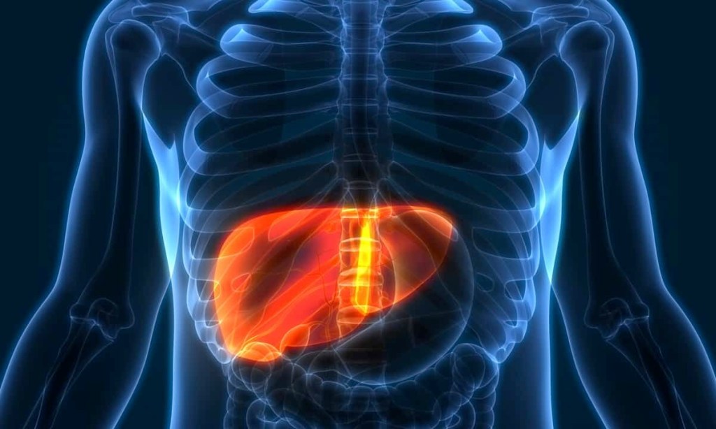 Everything You Need to Know About Fatty Liver Disease: Types, Symptoms, and&nbsp;Prevention